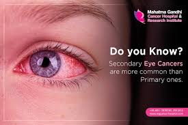 A rare eye cancer known as ocular melanoma has mysteriously struck groups of patients in two states. How Do You Know When You Have Eye Cancer