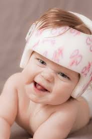 Quando Il Neonato Ha La Testa Storta O Schiacciata Plagiocefalia Ma Non Solo Amico Pediatra
