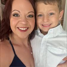 Timing and insurance coverage for skin removal after bariatric surgery?