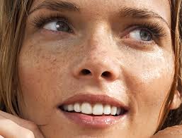 Best Lasers For Wrinkles Redness Texture More Goop