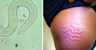 It is divided into two halves by a septum: 5 Truly Gross Parasites That Have Ruined Real People S Vacations