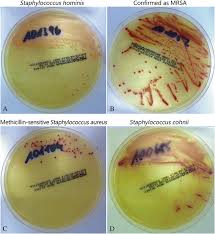 Maybe you would like to learn more about one of these? Screening Agars For Mrsa Evaluation Of A Stepwise Diagnostic Approach With Two Different Selective Agars For The Screening For Methicillin Resistant Staphylococcus Aureus Mrsa Military Medical Research Full Text