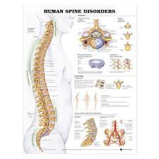 The skeleton acts as a scaffold by providing support and protection for the soft tissues that make up the. Human Spine Disorders Poster Spinal Disease Anatomical Chart Company