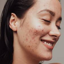 Manhattan Dermatology