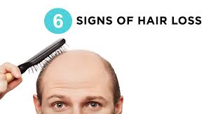 Here are 10 easy and practical ways to prevent and stop hair loss: 6 Early Signs You Re Going Bald 6 Ways To Fight It Irestore Laser Irestore Hair Growth System