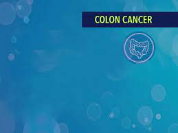 Bowel cancer is the third leading cause of cancer in the u.s. Treatment Of Stage I Iii Of Colon Cancer Cancerconnect