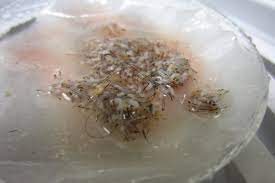 And as you know our natural oils are best to condition. Follicular Unit Extraction Hair Transplant Automation Options In Overcoming Challenges Of The Latest Technology In Hair Restoration With The Goal Of Avoiding The Line Scar