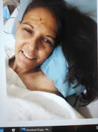 MVD Surgery with Dr. Z for Pain Relief