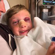 Little man had surgery today. Baseball to the face.