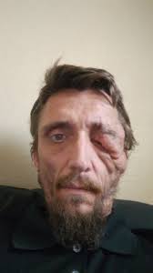 Any NF doctors for adults in Colorado or surrounding states?