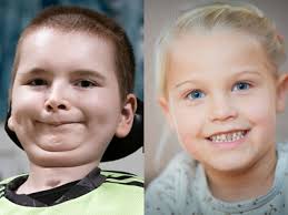 Husker du Sander og Merle, som fik tilbudt medicinen Spinraza?