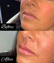 Nouveau Beauty Aesthetics