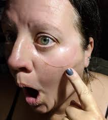 Marble eye vs. Cast eye for comfort