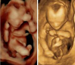 The best pictures are taken between 27 and 32 weeks. 22 Week 3d Ultrasound Pictures A Date With Baby