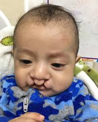 Hirsche Smiles Foundation...