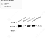 Electrophoresis Comb | Products | Servicebio