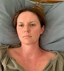 Hi, I'm Jess's cousin Sara. Jess and Rumi need help. Jess and Rumi are both  suffering from multiple complications of a connective tissue disorder they  both share. Their family shares features of