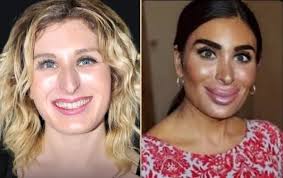 For absolutely no reason, here's a picture of Laura Loomer from 2017 next  to a one of her in 2023. PS