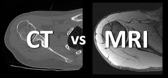 Mri and ct scans are diagnostic imaging scans used by doctors. What 8217 S The Difference Between An Mri And Ct Cincinnati Children S Blog