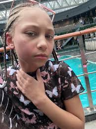 Our girl who was suffering from chlorine toxicity is practicing being  adorable today...But don't let those cute eyes fool you; she is spicy! 🔥  She is doing significantly better, and is officially