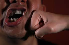 Jail For Man Who Punched Cabby Fracturing His Nose