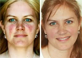 Shannon — VILLANI MEDICAL