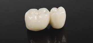 Durch eine krone können zerstörte zähne gerettet werden und vor neuer kariesbildung geschützt werden. Was Tun Bei Festsitzender Zahnersatz Dentics