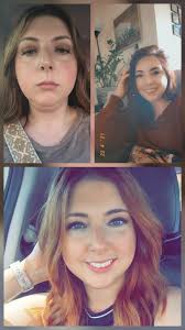 Managing Burning Mouth Syndrome with Dietary Changes and Specialist  Consultations