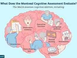 Montreal cognitive assessment (moca) version 3 administration and scoring instructions the montreal cognitive assessment (moca) was designed as a rapid screening instrument for. Montreal Cognitive Assessment Moca Test For Dementia