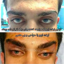 Welcome to specialty eye institute. Are Yall Ready For The New Cat Eye Plastic Surgery Trend Lipstick Alley