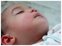It will help your baby to relax if you keep talking while you wash them. What Should You Do About The Red Dry And Itchy Skin In Newborns Times Of India