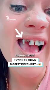 I couldn’t afford $18K repairs