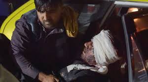 Un attentat à kaboul a fait au moins 85 morts et 160 blessés ce jeudi. 2s0w8ybhvfhuqm