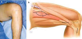 Image result for Laggera gracilis