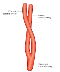 Arteries, arterioles, capillaries, venules and veins. Easy Notes On Common Carotid Arteries Learn In Just 4 Minutes Earth S Lab
