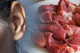 อาจารย์ ม.ดัง ซื้อเนื้อหมูสไลด์แช่แข็งจากห้างสรรพสินค้ามาทำ หมูกระทะ ติดเชื้อ โรคไข้หูดับ เสียชีวิต หลังหั่นหมูขณะมือเป็นแผล ไข้หูดับ หมอ. Lcddmsh6mdh2m