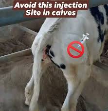 Image result for Lower Cervical Intramuscular Injection