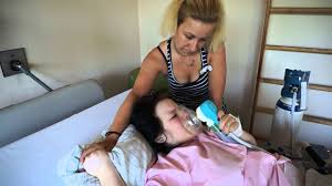 Wechsel des flocare peg konnektorshin und wieder kann es dazu kommen, dass der konnektor der flocare peg sonde aufgrund einer verstopfung, beschädigung oder. Lachgas Bei Der Geburt Die Alternative Zur Pda Babyartikel De Magazin