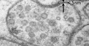 We did not find results for: Cell Membrane Under Electron Microscope Google Search Microscopy Cells Electron Microscope Cell Membrane