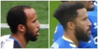 Andros Townsend's Secret Hair Transplant