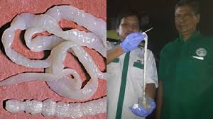 We did not find results for: Cacing Pita 10 5 Meter Hidup Dalam Perut Seorang Warga Penyebabnya Karena Makan Ini Sriwijaya Post