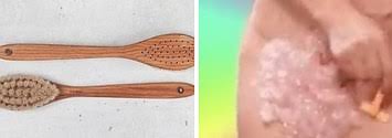 Hair removal creams, also known as depilatory creams, are available without a prescription. Hairy Girls What Are Your Tips For Hair Removal