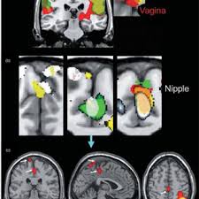 Reversible pulpitis may resolve following the removal of the offending stimulus. Pdf The Whole Versus The Sum Of Some Of The Parts Toward Resolving The Apparent Controversy Of Clitoral Versus Vaginal Orgasms