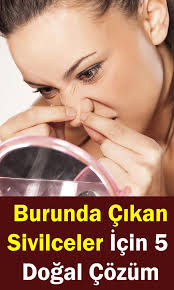 Burunda Sivilce Cikmasi Nedenleri Burunda Cikan Sivilce Nasil Gecer Sosyolife Net Ev Yapimi Cilt Bakimi Cilt Bakimi Tuyolari Cilt Bakimi