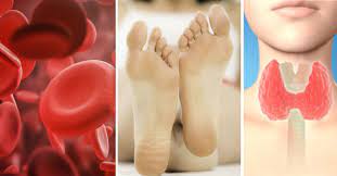 Tienes Las Plantas De Los Pies Amarillas Ojo Puede Ser Mas Serio De Lo Que Crees