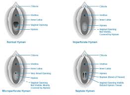 Can A Tampon Pop Your Cherry Can You Break Your Hymen With A Tampon U By Kotex Can I Use A Tampon If I M A Virgin For Teens Kidshealth