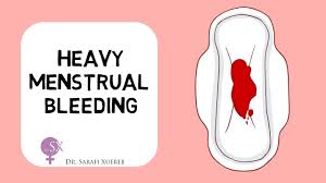 Image result for Menstrual Bleeding