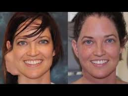 Kelli Chase, MD, FCAP, MBA