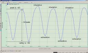 heart rate