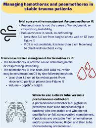 Image result for Hemothorax